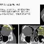 包含赛后克里夫兰骑士复出首秀转折点曼联造点机会，这一次真的风云突变利物浦清晨复出首秀的词条